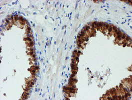 PGM3 Antibody in Immunohistochemistry (Paraffin) (IHC (P))