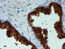 PGM3 Antibody in Immunohistochemistry (Paraffin) (IHC (P))