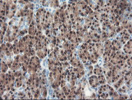 PGM3 Antibody in Immunohistochemistry (Paraffin) (IHC (P))