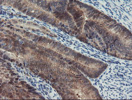 PGM3 Antibody in Immunohistochemistry (Paraffin) (IHC (P))