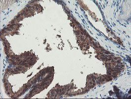 PGM3 Antibody in Immunohistochemistry (Paraffin) (IHC (P))