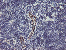 PGM3 Antibody in Immunohistochemistry (Paraffin) (IHC (P))