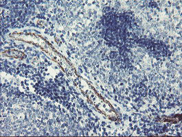 PGM3 Antibody in Immunohistochemistry (Paraffin) (IHC (P))