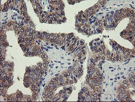 PGM3 Antibody in Immunohistochemistry (Paraffin) (IHC (P))