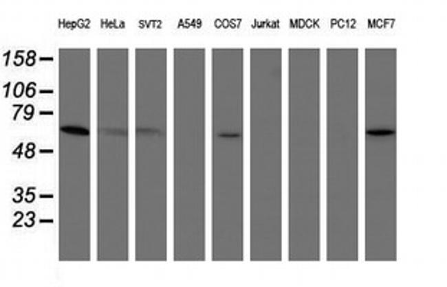 PGM3 Antibody in Western Blot (WB)