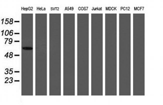 PGM3 Antibody in Western Blot (WB)