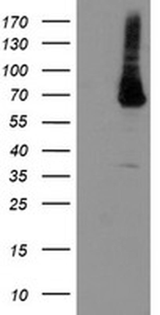 PGM3 Antibody in Western Blot (WB)