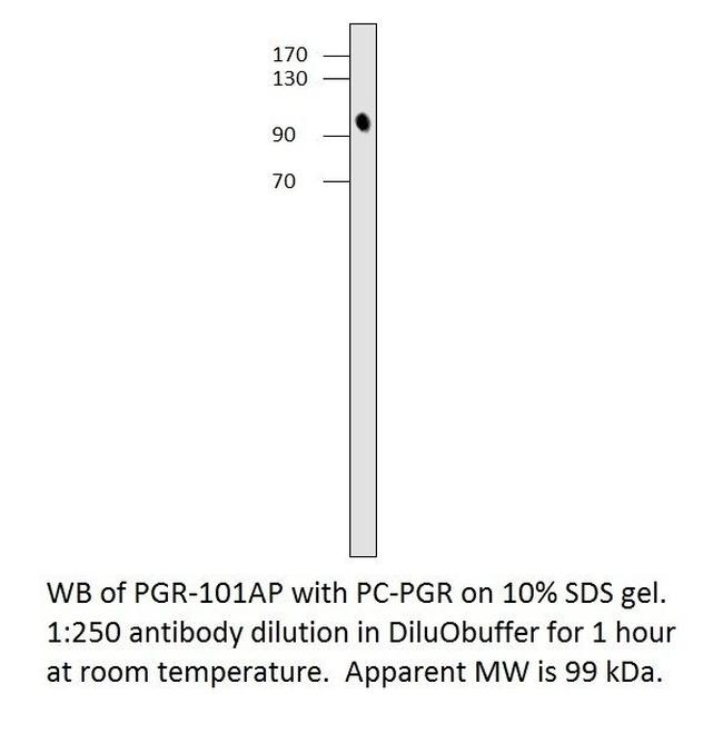 Progesterone Receptor Antibody in Western Blot (WB)