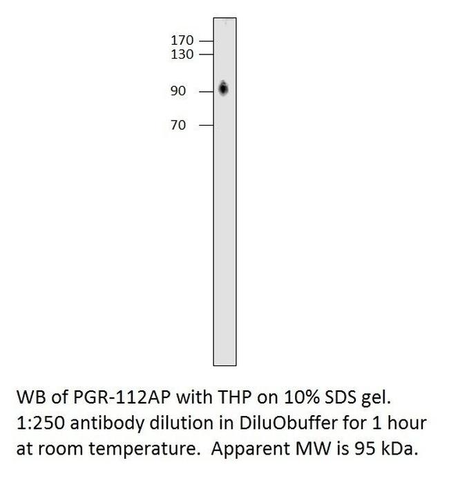 Progesterone Receptor Antibody in Western Blot (WB)