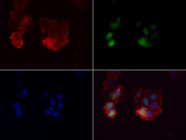 PGR Antibody in Immunocytochemistry (ICC/IF)