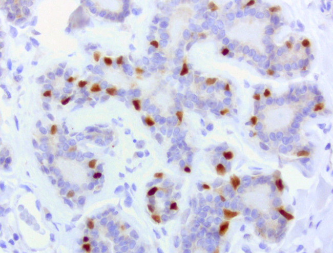 PGR Antibody in Immunohistochemistry (Paraffin) (IHC (P))