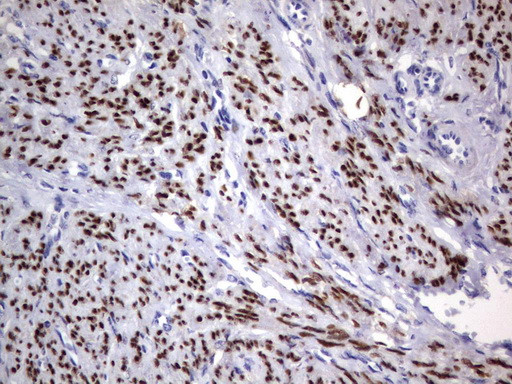 PGR Antibody in Immunohistochemistry (Paraffin) (IHC (P))