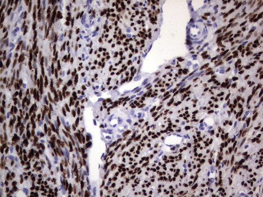 PGR Antibody in Immunohistochemistry (Paraffin) (IHC (P))