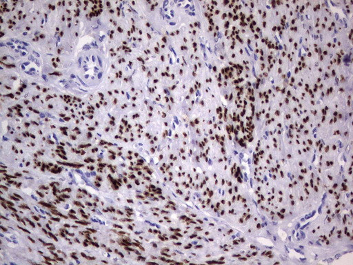 PGR Antibody in Immunohistochemistry (Paraffin) (IHC (P))