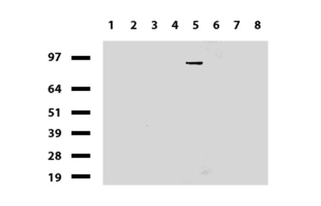 PGR Antibody in Western Blot (WB)