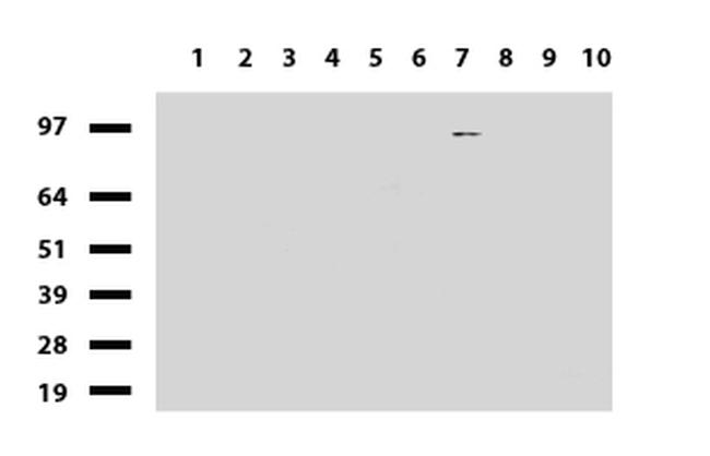 PGR Antibody in Western Blot (WB)