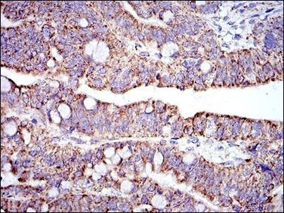 Prohibitin Antibody in Immunohistochemistry (Paraffin) (IHC (P))