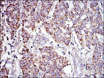 Prohibitin Antibody in Immunohistochemistry (Paraffin) (IHC (P))