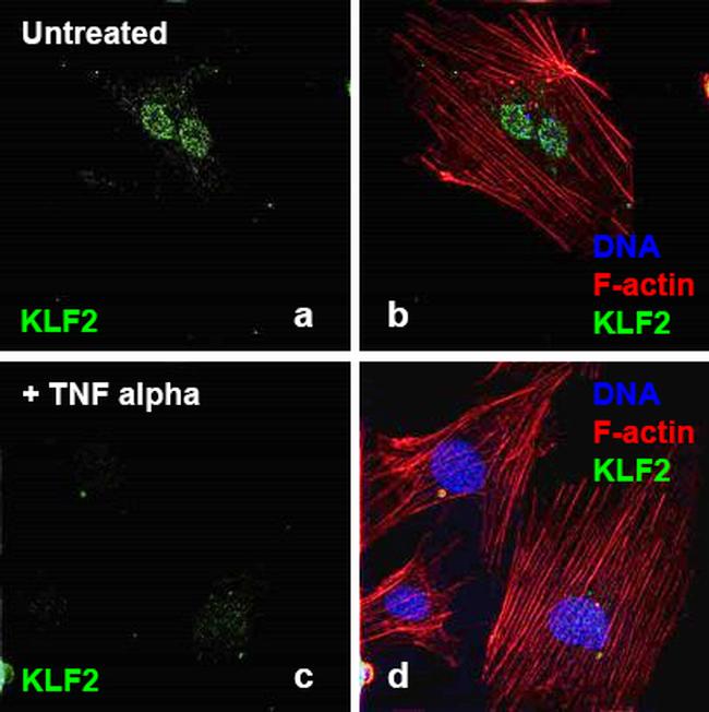 Human TNF-alpha Protein in Functional Assay (Functional)