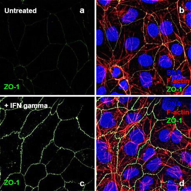 Human IFN-gamma Protein in Functional Assay (Functional)