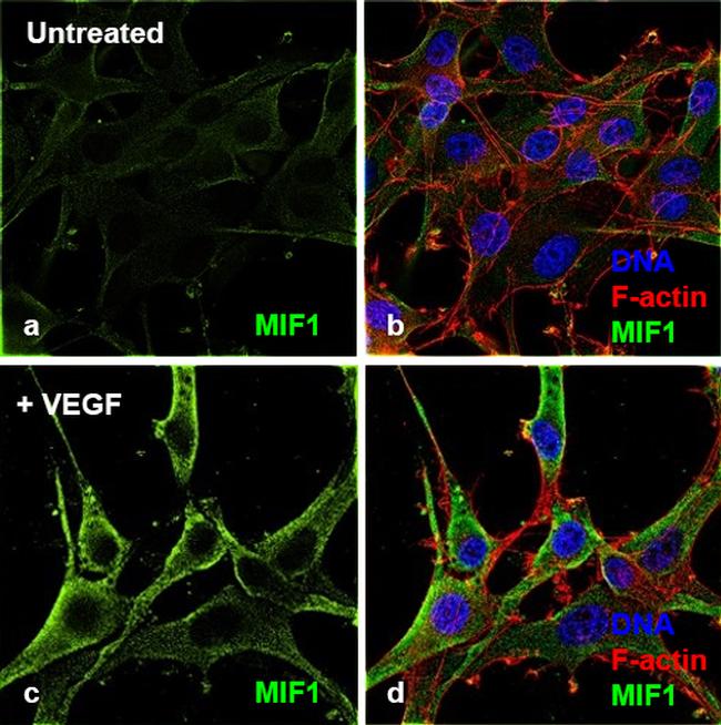 Human VEGF-165 Protein in Functional Assay (FN)