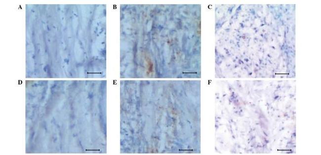 PHD3 Antibody in Immunohistochemistry (Paraffin) (IHC (P))