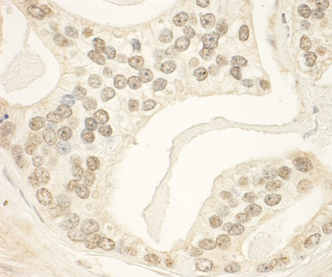 PHF23 Antibody in Immunohistochemistry (IHC)