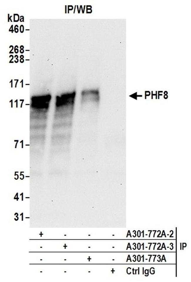 PHF8 Antibody in Western Blot (WB)