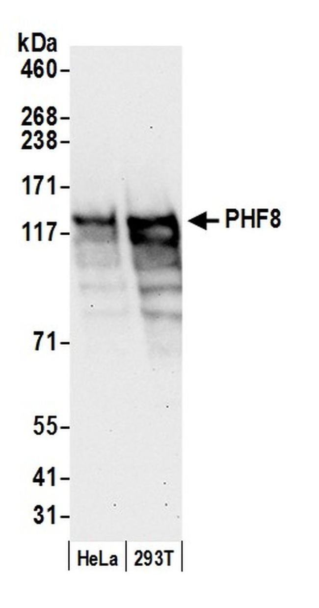 PHF8 Antibody in Western Blot (WB)