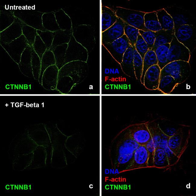 Human TGF-beta 1 Protein in Functional Assay (FN)