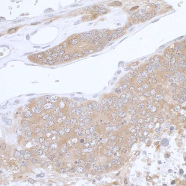 PHGDH Antibody in Immunohistochemistry (IHC)