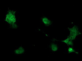 PHKG2 Antibody in Immunocytochemistry (ICC/IF)