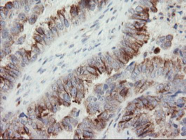 PHKG2 Antibody in Immunohistochemistry (Paraffin) (IHC (P))