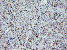 PHKG2 Antibody in Immunohistochemistry (Paraffin) (IHC (P))