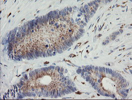 PHKG2 Antibody in Immunohistochemistry (Paraffin) (IHC (P))