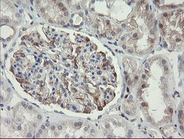 PHKG2 Antibody in Immunohistochemistry (Paraffin) (IHC (P))