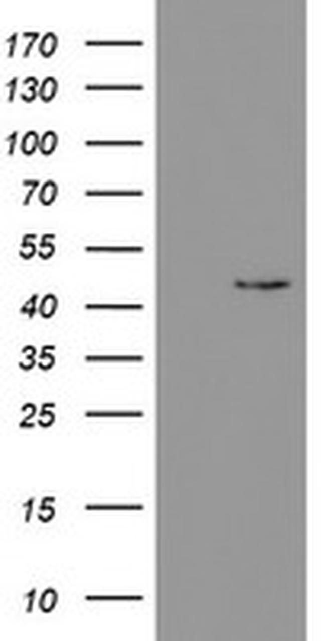 PHKG2 Antibody in Western Blot (WB)