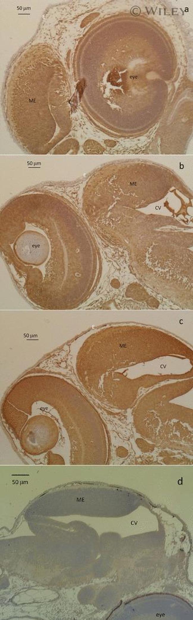 HSP70 Antibody in Immunohistochemistry (IHC)