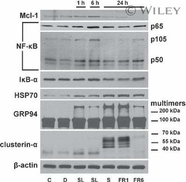 HSP70 Antibody in Western Blot (WB)