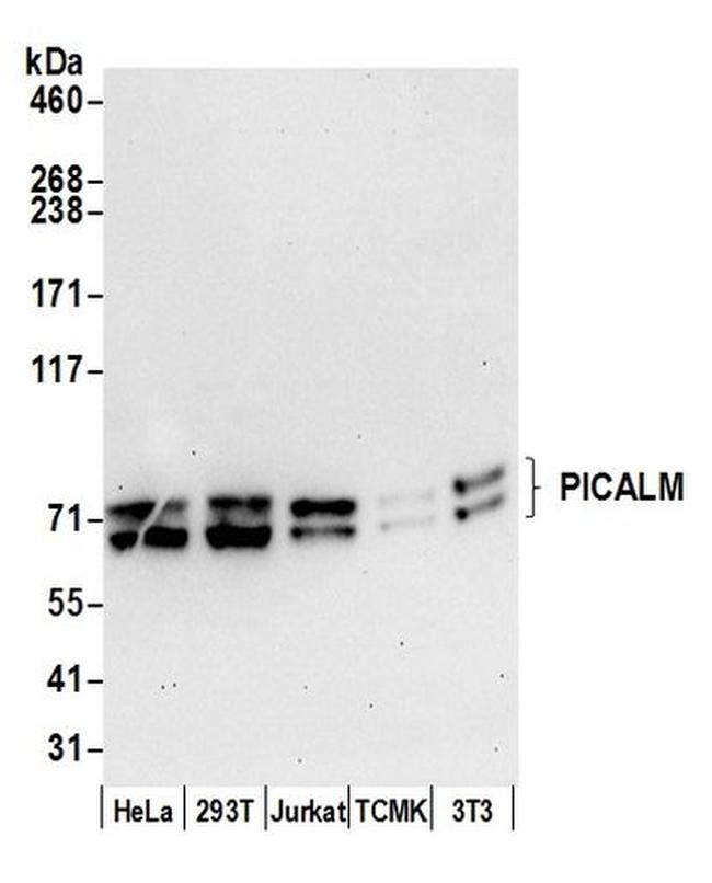 PICALM/CALM Antibody in Western Blot (WB)