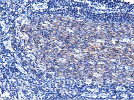 PIK3AP1 Antibody in Immunohistochemistry (Paraffin) (IHC (P))