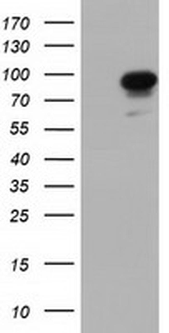 PIK3AP1 Antibody in Western Blot (WB)