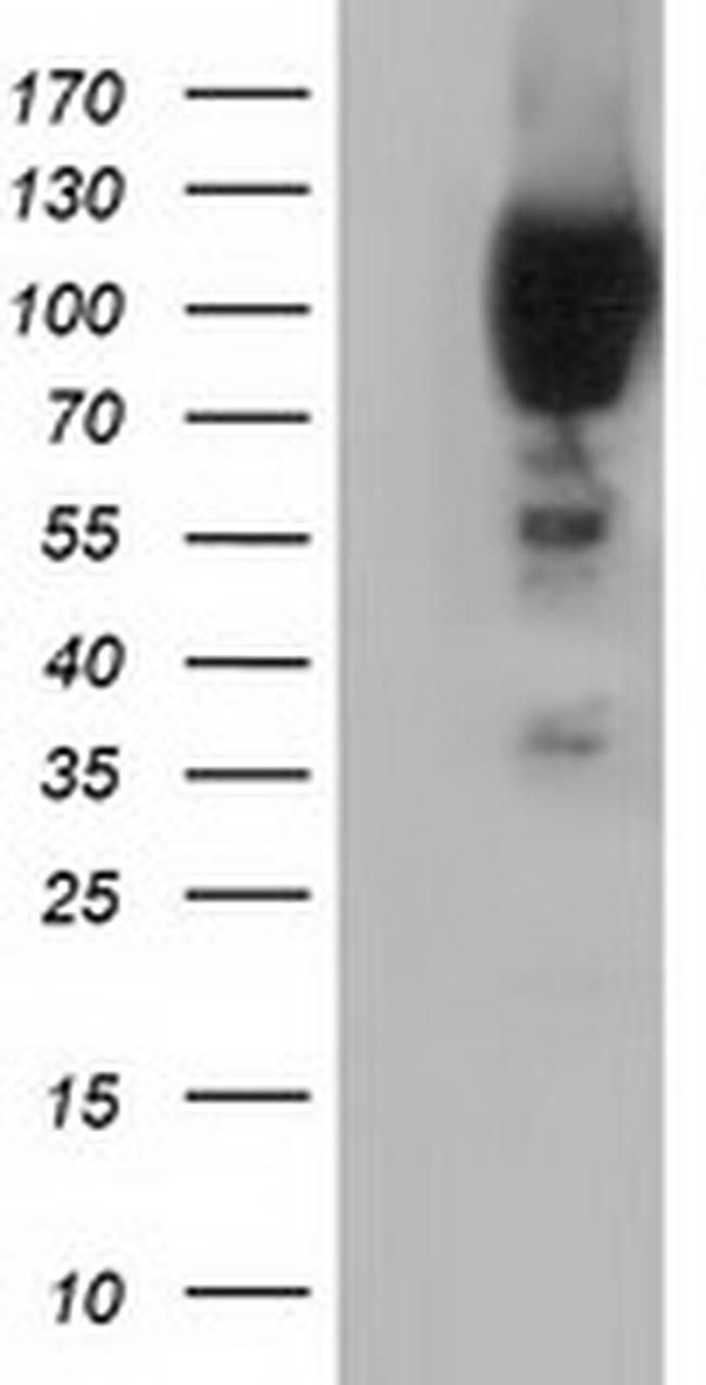 PIK3AP1 Antibody in Western Blot (WB)