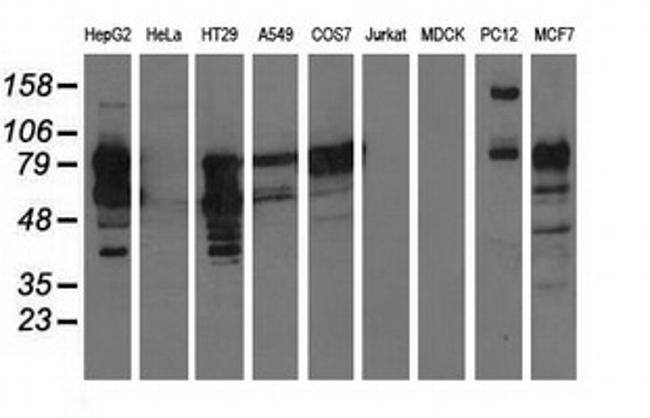 PIK3AP1 Antibody in Western Blot (WB)