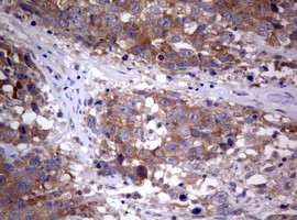 PIK3C2A Antibody in Immunohistochemistry (Paraffin) (IHC (P))