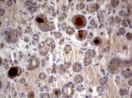 PIK3C2A Antibody in Immunohistochemistry (Paraffin) (IHC (P))