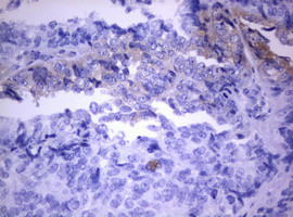 PIK3C2A Antibody in Immunohistochemistry (Paraffin) (IHC (P))