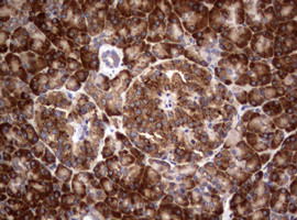 PIK3C2A Antibody in Immunohistochemistry (Paraffin) (IHC (P))