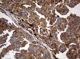 PIK3C2A Antibody in Immunohistochemistry (Paraffin) (IHC (P))