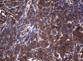 PIK3C2A Antibody in Immunohistochemistry (Paraffin) (IHC (P))